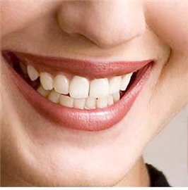 5 способов отбеливания зубов