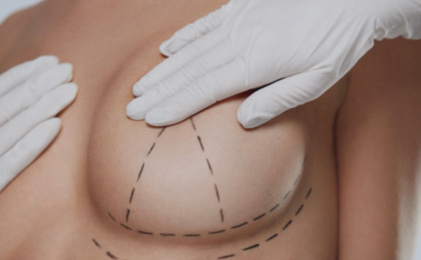 Какие виды пластики груди предлагают хирургические клиники?