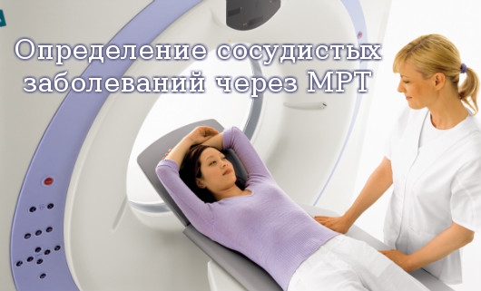 сосудистых заболеваний через МРТ